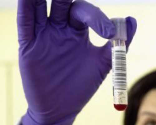 试管婴儿如何提高着床率？试管婴儿如何提高着床率？