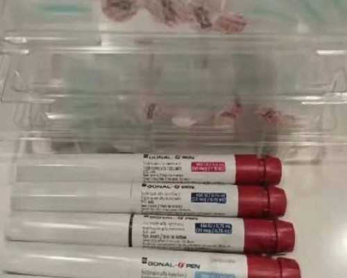 通过什么检查可确诊是多囊卵巢综合征？，助孕代生机构