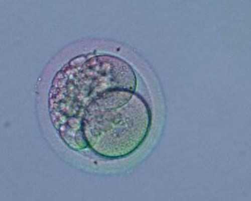 「移植方案HRT」移植冻胚HRT是什么方案