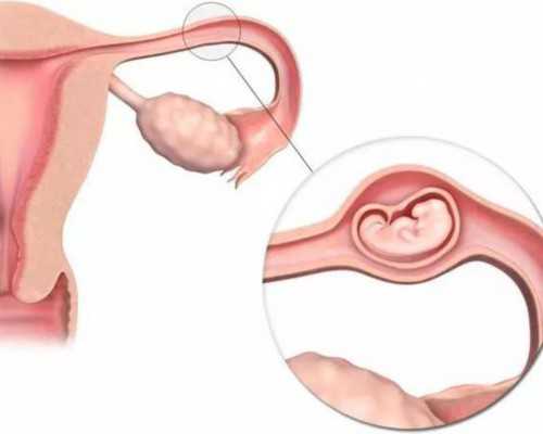 染色体有问题可以做试管 女性染色体有问题可以做试管吗