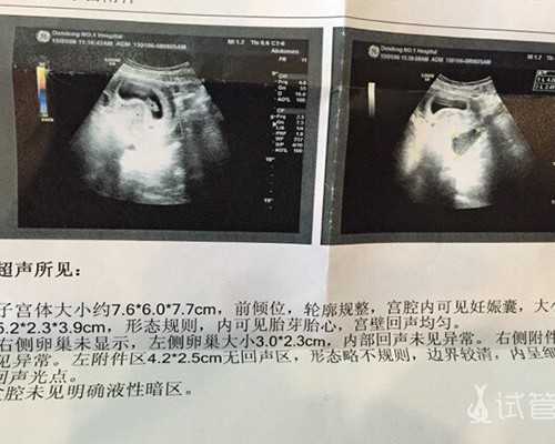 国内供卵有哪些医院,取卵38个配成27个做试管成功率高，前提：医生叫养囊要听话